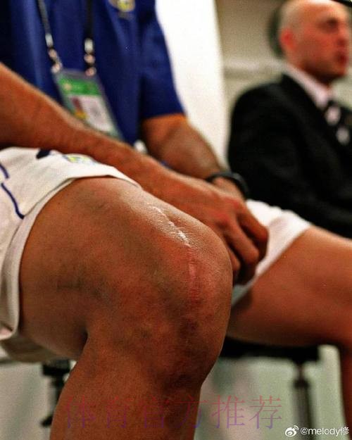 皇马官方：罗德里戈右腿股二头肌肌腱受伤